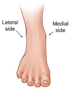 Medial side and lateral side of the ankle