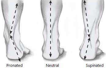 Pronated Neutral Supinated foot