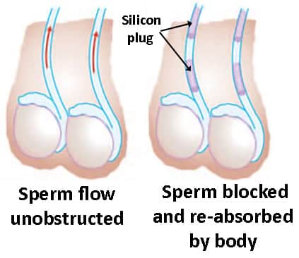 Silicon plug